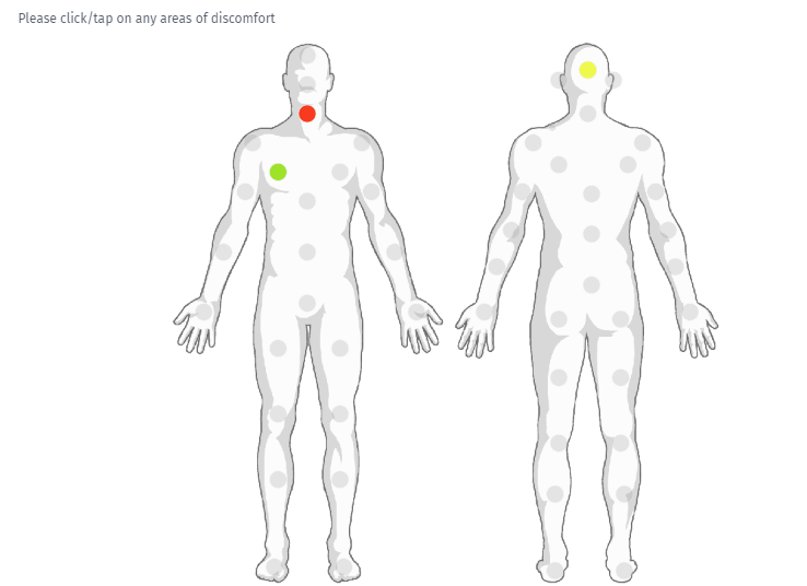 Homunculus question